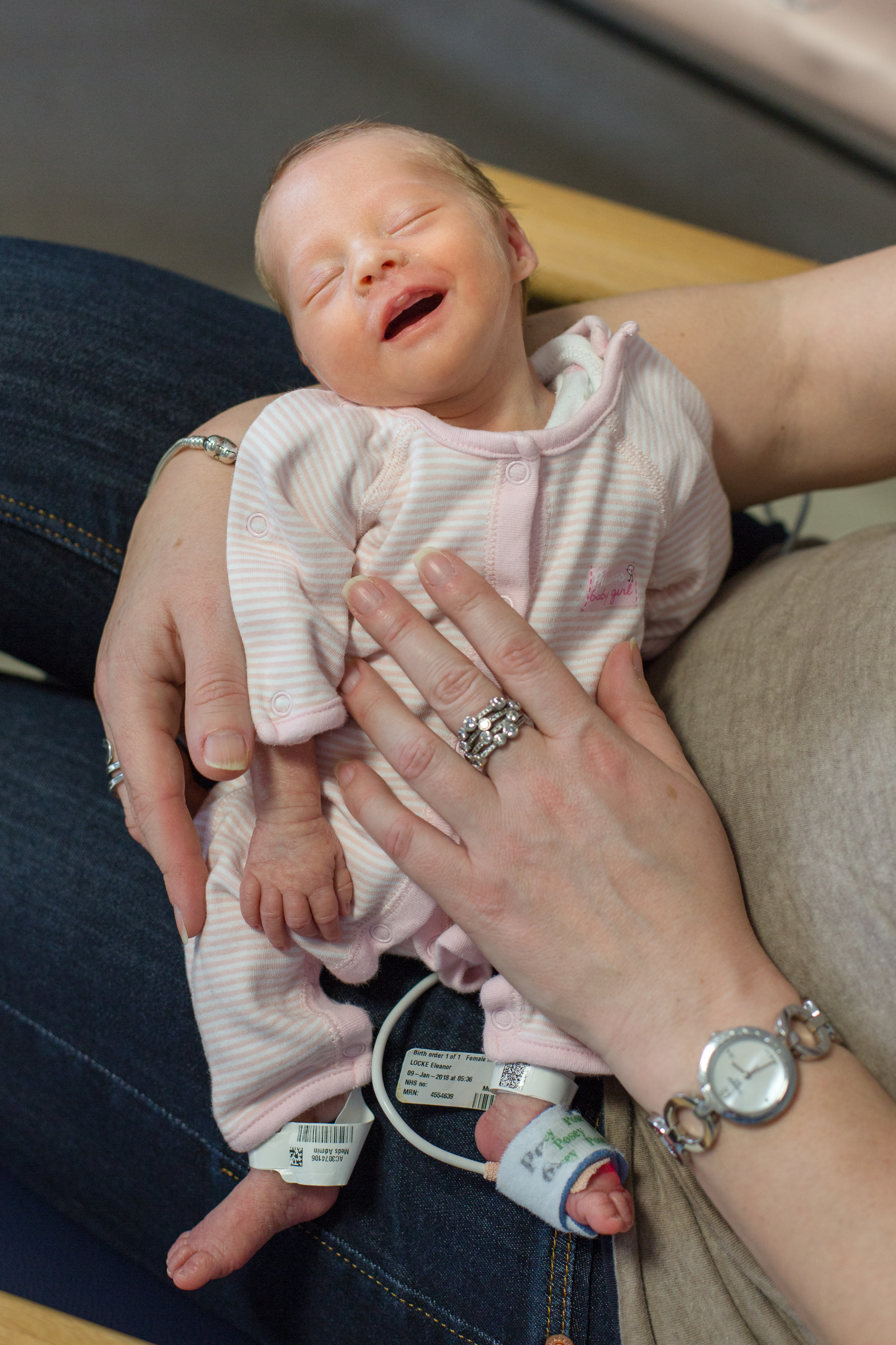 Neonatal premature baby photography Surrey