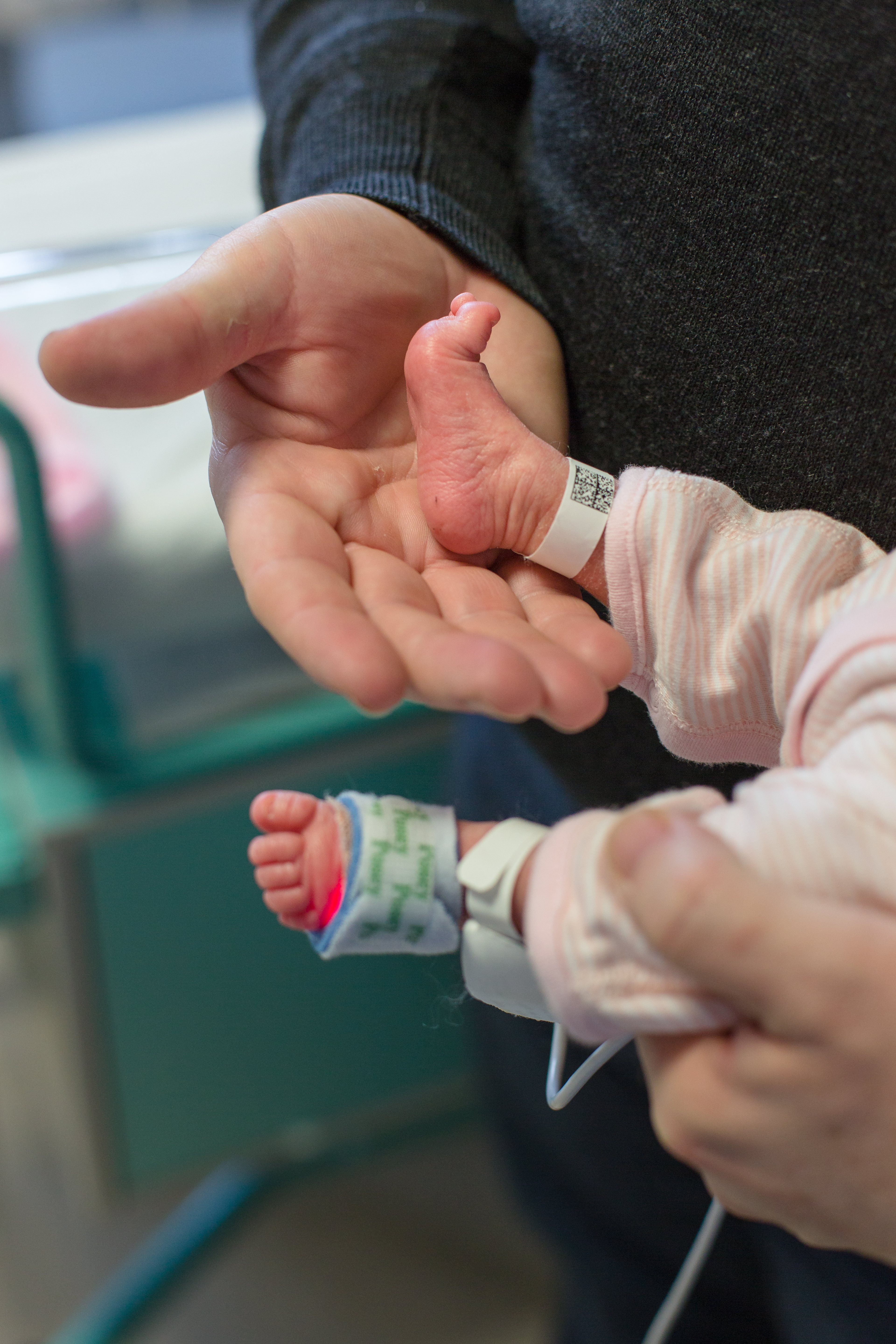 Tiny toes Neonatal premature baby Kingston hospital
